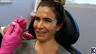 Dissolving Under Eye Filler with @AgostinaFitness