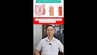 Learn about the Causes of Colitis  -  How to Treat Colitis ? #colitis #causesofcolitis