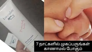 becalm airy face wash for oily skin review in tamil #oilyskin 