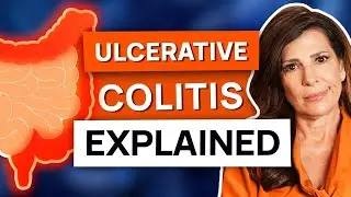 ULCERATIVE COLITIS: How to treat Ulcerative Colitis? Ulcerative Colitis SIGNS