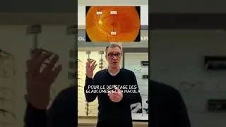 Le fond d'&oelig;il et l'observation de la r&eacute;tine.