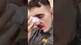 🔥 Tom Aspinall Eye Injury Update  #mma #ufc #ufcfighter #mma #boxing #sports #eyeinjury #update