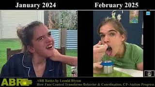 ABR &ndash; Face Control Improves Behavior & Movement  CP&ndash;Autism Progress Explained by Leonid Blyum