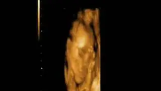 4D ultrasound of baby michael Scott Mathis