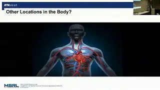 Soft Microrobotics and its Application in Medecine