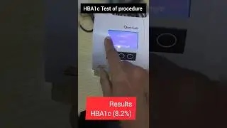 Quo-Lab HBA1c Analyser || 3 month blood sugar test | HBA1c Test #hba1c #shorts #sugar #short #doctor