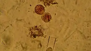 Bedford Basin Phytoplankton: 2024-05-29, 40X magnification: Alexandrium