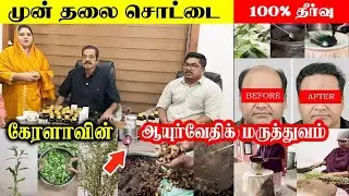 வழுக்கையில் முடி வளர இதை பண்ணுங்க 💯% ரிசல்ட் - vijayan master ayurveda hospital 