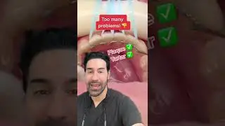 #dentist These permanent retainers suck!! Get this instead🔑 #dentist #tooth #te