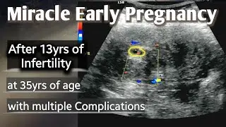 Miracle Early Pregnancy Ultrasound - with multiple complications | after 13yrs Infertility