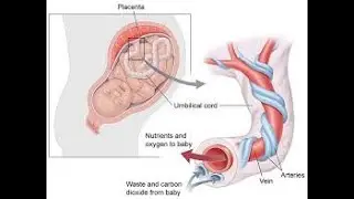 Umbilical Cord Blood Gas Analysis Test Artery or Vein ; Definition, procedure, Uses, Why it is done