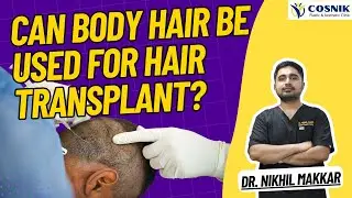 Body Hair in Hair Transplant: Does It Work Like Scalp Hair? | Dr. Nikhil Makkar Explains