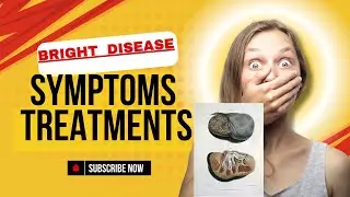 Bright {Kidney} Disease: Symptoms, Risk Factors & Treatments