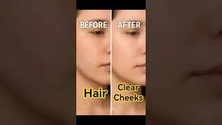 Unwanted Facial Hair? Remove It Instantly at Home!