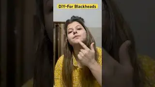 Blackheads removalNew this week|blackhead new this week|blackhead new 2025