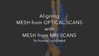 Aligning Mesh from Optical Scans with Mesh from MRI Scans
