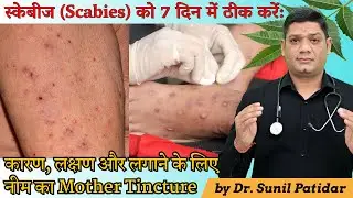 Homeopathic Medicines for Scabies | Causes, Symptoms & Treatment by Dr. Sunil Patidar #Scabies
