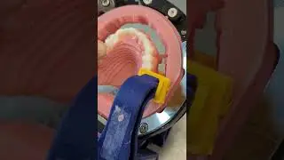 utilize the self curing resin to bond teeth to base in oversized milling strategy.