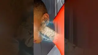 Police incompetence left him paralyzed 😔😡