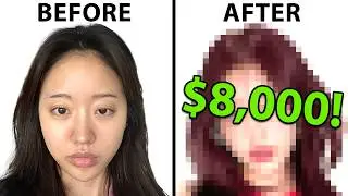 Plastic Surgeon Reacts To $8,000 EXTREME Korean Glow Up