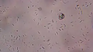 Legionella, E. Coli, and Mold Spores under 2500x magnification.