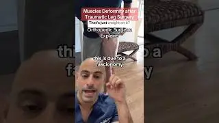 Surgeon Reacts - Deformity After Leg Surgery