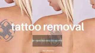 Powerful Tattoo Removal ―∎𝘢𝘶𝘥𝘪𝘰 𝘢𝘧𝘧𝘪𝘳𝘮𝘢𝘵𝘪𝘰𝘯𝘴 | Get Rid of Unwanted Tattoos