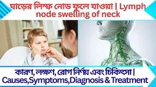 ঘাড়ের লিম্ফ নোড ফুলে যাওয়া | Lymph node swelling of neck | কারণ, লক্ষণ, রোগ নির্ণয় এবং চিকিৎসা 
