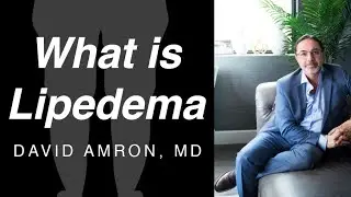 What is Lipedema? | United States | David Amron, MD