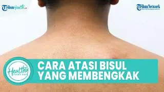 Bisul Dapat Bengkak lalu Jadi Penyakit Ganas, Begini Cara Tepat Atasi dengan Obat Herbal