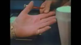 Aversion Therapy 1970's