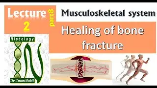 2h- Healing of a bone fracture التئام كسر العظام