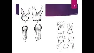 ANATOMY OF PRIMARY TEETH