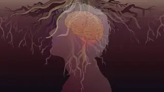 HUMAN BRAIN & TREE ROOTS. What's common?
