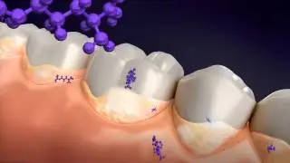 Colgate Maximum Cavity Protection plus Sugar Acid Neutralizer (SAN) &ndash; How It Works