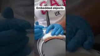 #shorts #stabbing #firstaid