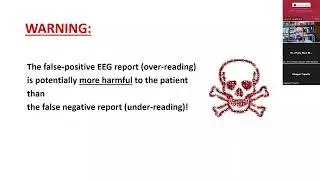 10th NATIONAL EEG WORKSHOP