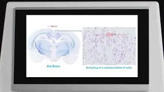 MiniPunch : Automated tissue dissection