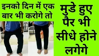 best exercises for bow legs correction bow leg exercises due to knee pain knee arthritis in hindi