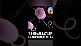 Nightmare Bacteria on the Rise in U.S. | Superbug Health Alert 🦠