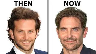 Did Bradley Cooper Have Plastic Surgery?