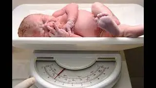 Breastfeeding Your Baby: Losing 10% of Birth Weight