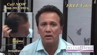 Hair Stranding- Non-Surgical Hair Replacement New Jersey.Last 3-4 Years-InvisaBlend