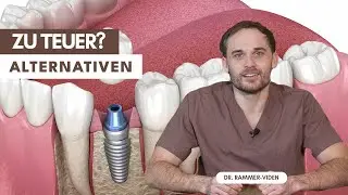 Kein Implantat? Diese 4 Alternativen erkläre ich meinen Patienten ehrlich