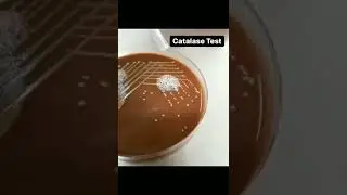 🧪Catalase Test 💯🧪 #labtechnician #microbiology #medical #respect #status  #bacteria #media