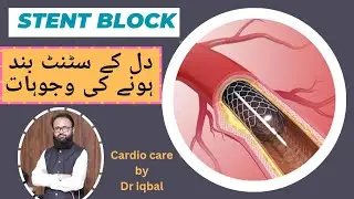 Causes of stent block Urdu | Dil k stent band hony Ki waja | heart stent block Hindi