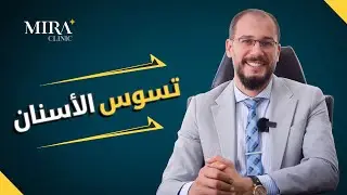 اسباب تسوس الأسنان و اعراضها و طرق التخلص منها وعلاجها و الوقاية منها ومتى يجب زيارة دكتور الاسنان