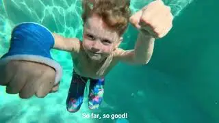 Application and removal of a waterproof cast on a child
