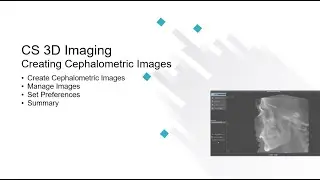 CS 3D Imaging: Creating Cephalometric Images Recorded Class