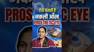 Artificial eyes are made from acrylic! Prosthetic Eye #facts #eyedoctor #doctor